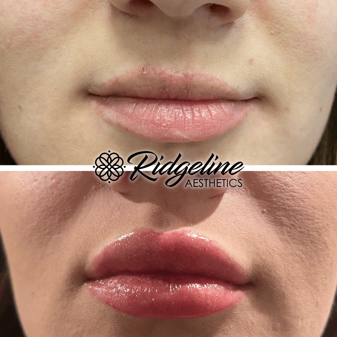 Face & Body Sculpting (2) - Ridgeline Aesthetics